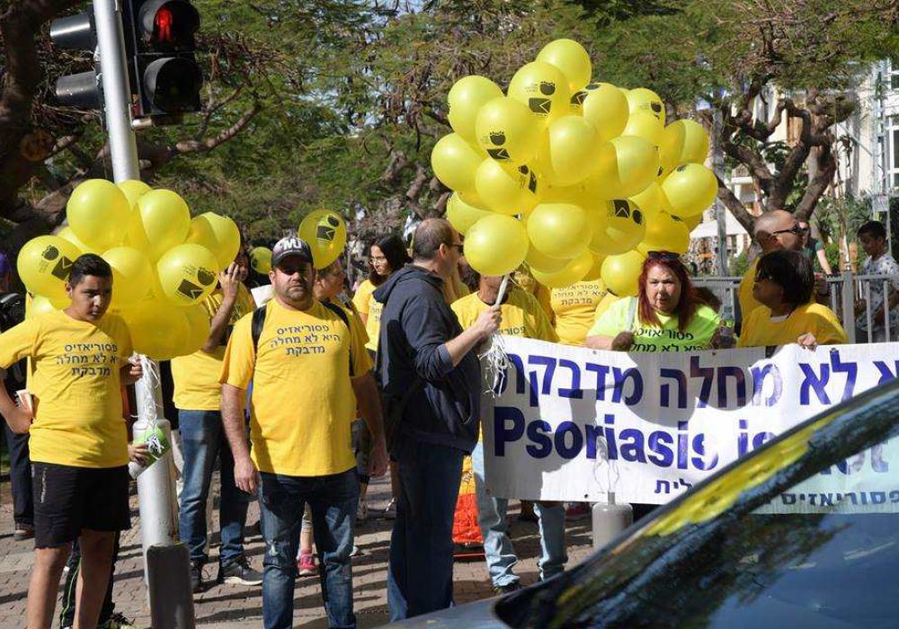 פסוריאזיס היא לא מחלה מדבקת